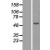 Western Blot: MMP19 Lysate [NBL1-13155] - Western Blot experiments. 
Left-Control; Right -Over-expression Lysate for MMP19